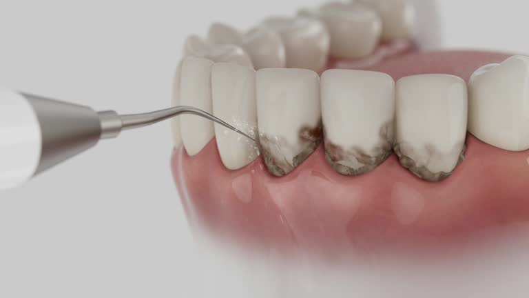 Trusted Dental Implants service in Samsula-Spruce Creek, FL - Dentist Open Now